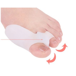 Bộ bảo vệ ngón chân Hallux Valgus Bộ sửa ngón chân cái