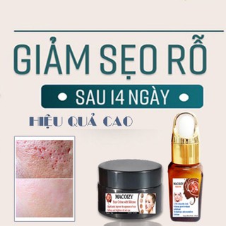 Bộ Serum Kem Xóa Sẹo Rỗ Sẹo Mụn Lâu Năm
