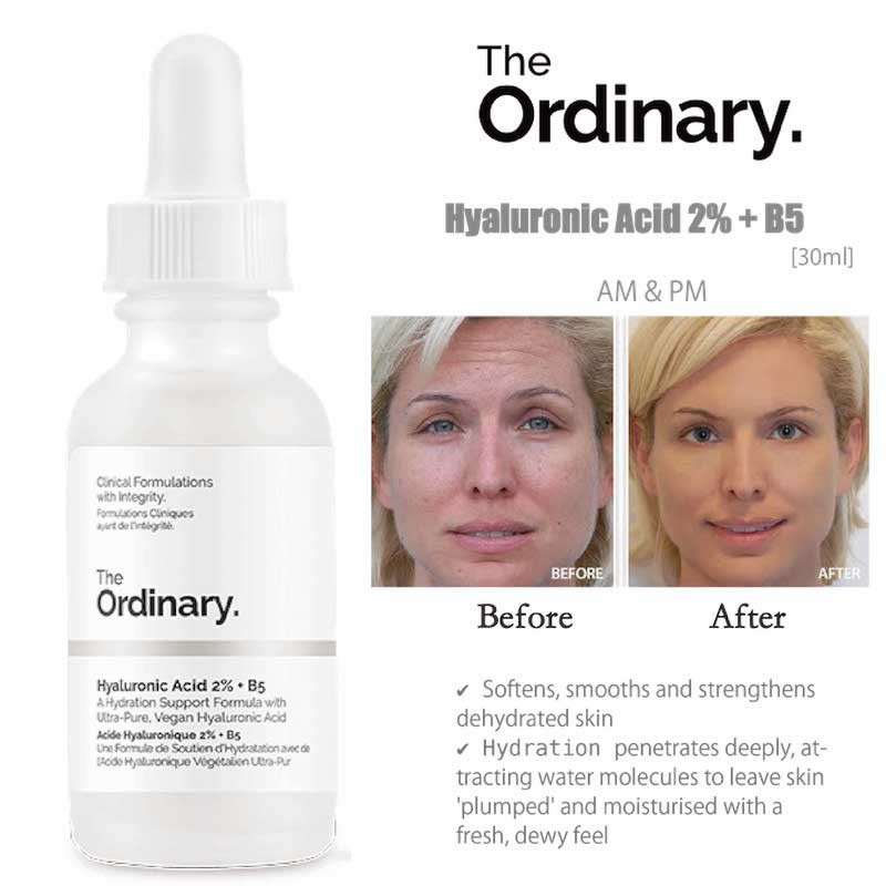THE ORDINARY tinh chất chống lão hóa và Hyaluronic Acid 2% + B5 30ml | BigBuy360 - bigbuy360.vn