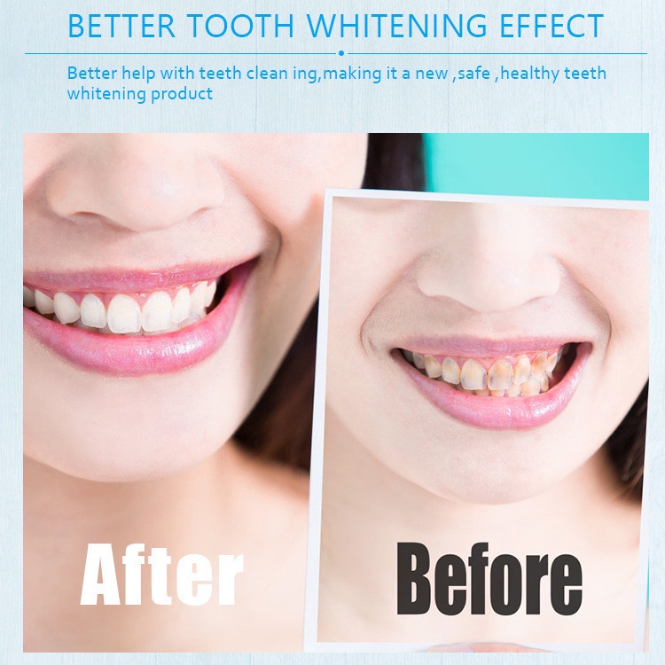 1 Miếng dán trắng răng 5D  White Teeth Whitening Strips - Miếng dán trắng răng an toàn - không bào mòn - ít ê buốt