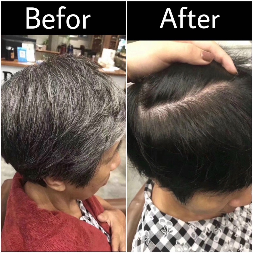 Nhuộm đen HD - Không Dính Da Đầu