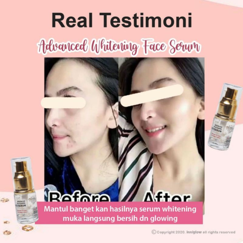 (Hàng Mới Về) Serum Trị Mụn Làm Trắng Da Chống Lão Hóa Và Sẹo