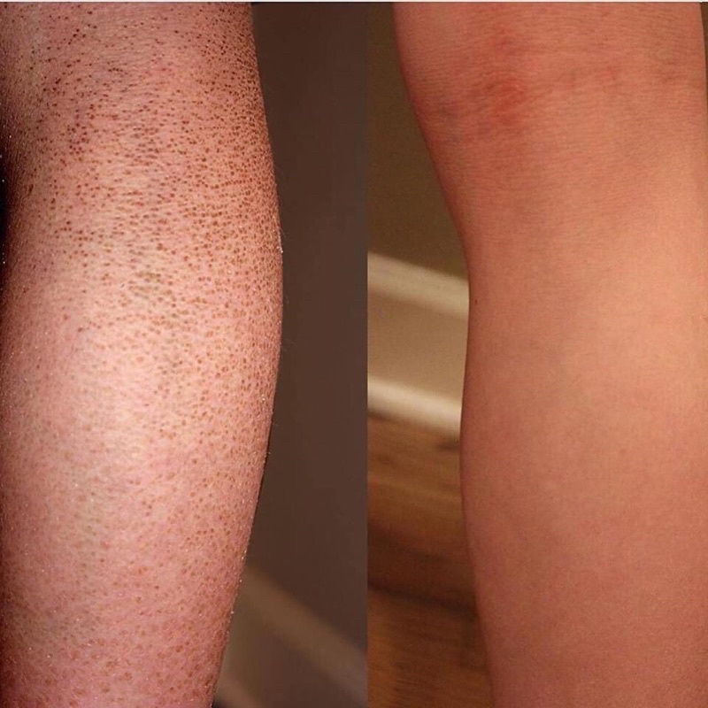 Lotion dưỡng da toàn thân Amlactic Daily Body Lotion 567gram