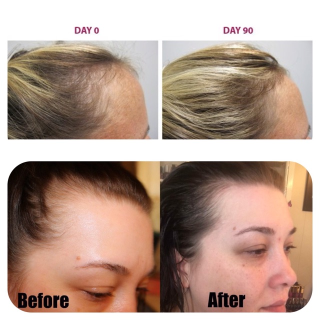 Dầu dưỡng tóc The Ordinary Multi-Peptide Serum For Hair Density | BigBuy360 - bigbuy360.vn