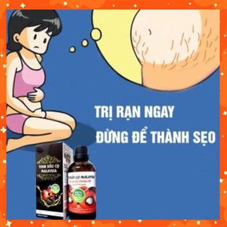 [Hàng mới] Tinh Dầu Cọ Malaysia Lọ 100ml Cho Mẹ Trước Và Sau Sinh