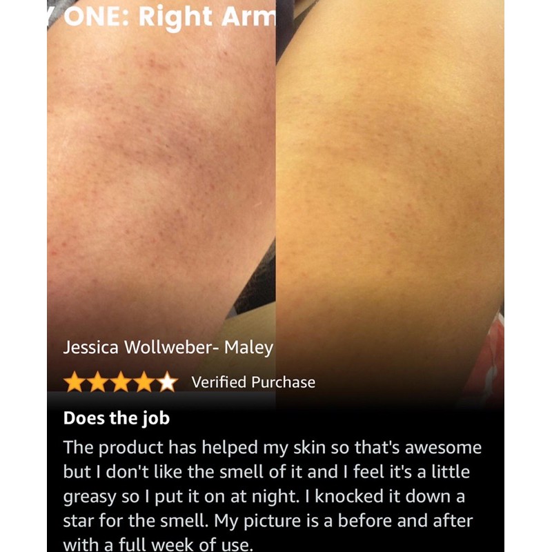 Allbyvy  KEM DƯỠNG BODY GOLD BOND