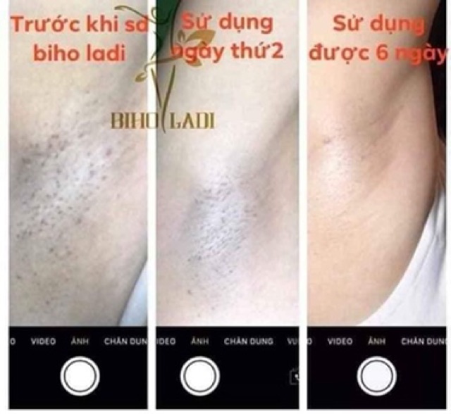 BIHO LADI kem đặc trị thâm hôi (nách, bẹn, Mông, bikini) | BigBuy360 - bigbuy360.vn
