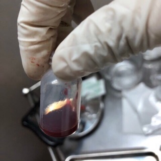 [SKIN HOUSE] 10 ỐNG NHỰA HÚT MÁU BẦM 5ml