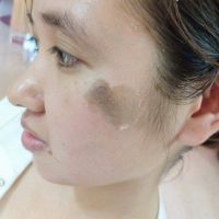 bộ mỹ phẩm thay da face tca usa