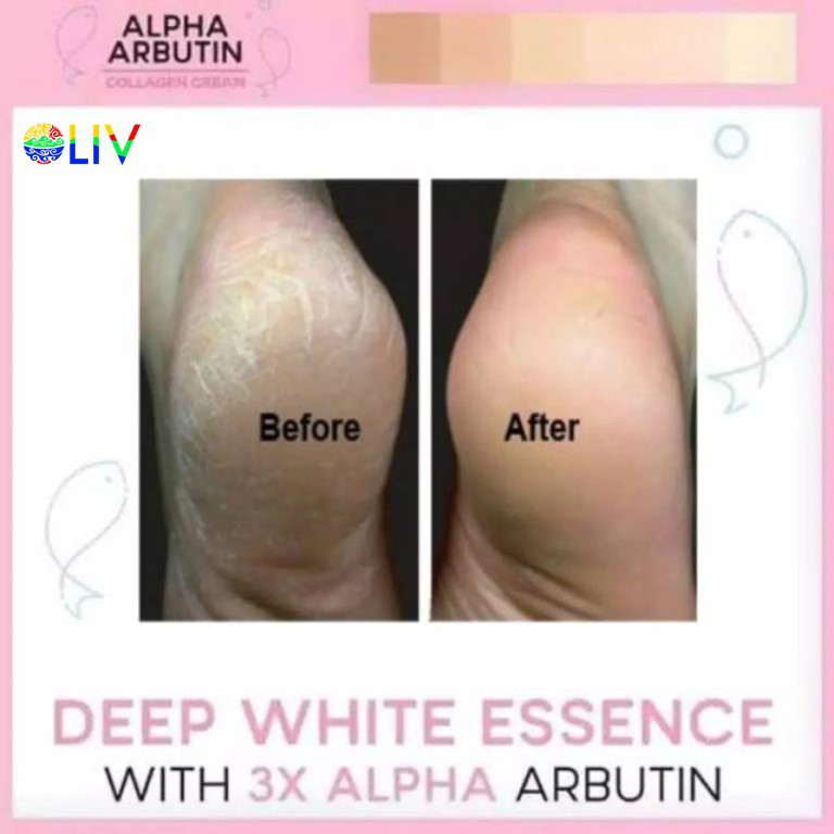 Alpha Arbutin (Hàng Mới Về) Kem Dưỡng Trắng Da Chứa Collagen 3 Plus Alpha Arbutin