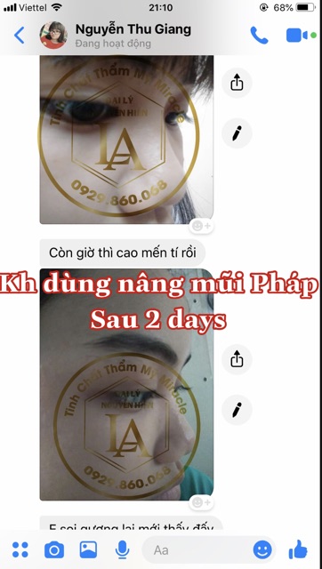 Tinh chất nâng mũi Pháp Miracle | BigBuy360 - bigbuy360.vn
