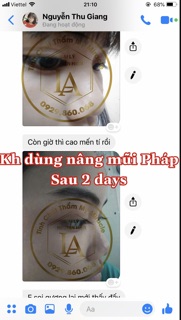 [ HÀNG CAO CẤP ] Tinh chất nâng mũi Pháp Miracle
