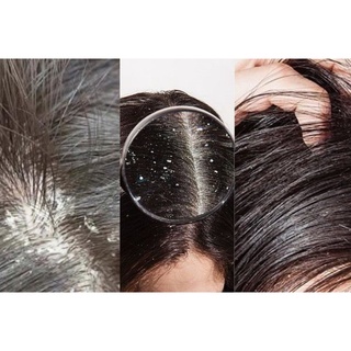 Gội Gàu Nấm DR CELL