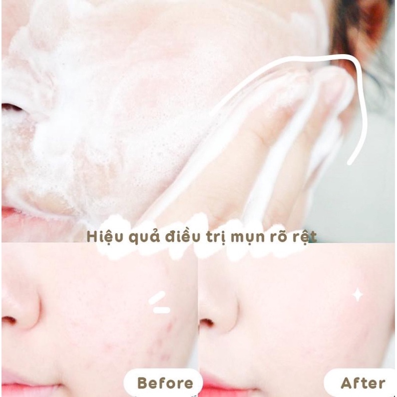 Sữa rửa mặt PHA 5.5 ph Balancing PHA Cleansing Foam 130g