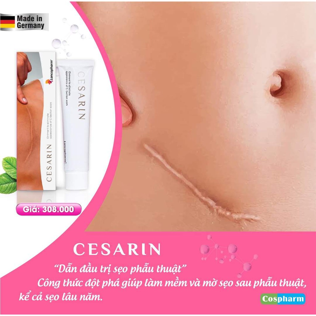 Kem Sẹo Phẫu Thuật CESARIN-Lancopharm 30g -Sẹo Sau Mổ Sinh,Làm Phẳng Sẹo Và Mờ Vết Rạn Da