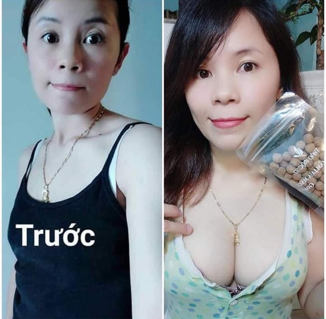 Kẹo mầm lúa mạch GOLD Thảo Mộc 37 [Chính Hãng-Date Mới] | BigBuy360 - bigbuy360.vn