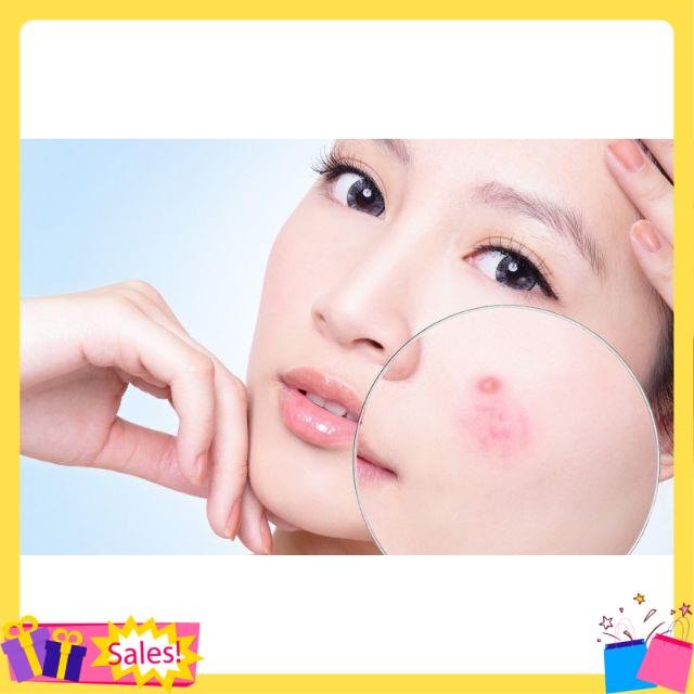 kem dưỡng ẩm la roche posay b5 - Làm Dịu Và Phục Hồi Da 100ml SkinCareOffcial | BigBuy360 - bigbuy360.vn