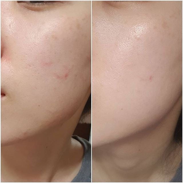 Kem chống nắng Skin1004 Centella Madagascar