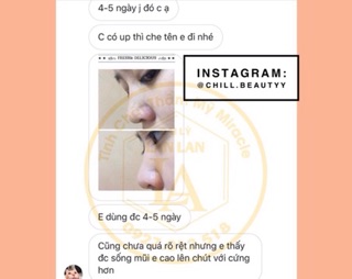 [HOT] Tinh chất nâng mũi Hàn Quốc