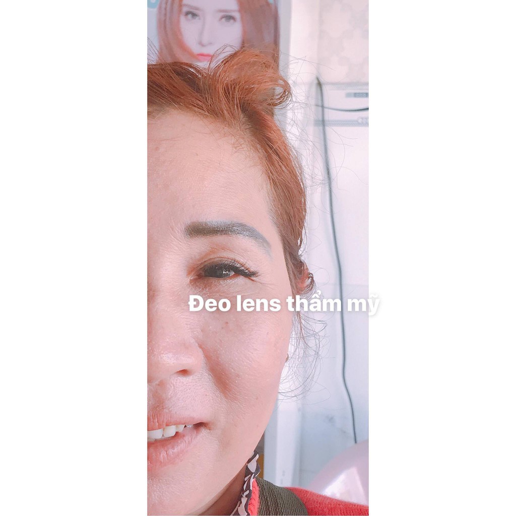 Kính Áp Tròng / Lens mắt THẨM MỸ che khuyết điểm khi bị tật 1 bên mắt