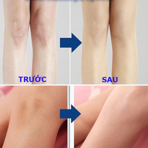 Tất che khuyết điểm chân Yufit Airbrush, che khuyết điểm không trôi, che sẹo thâm, make up nâng tone cực tốt