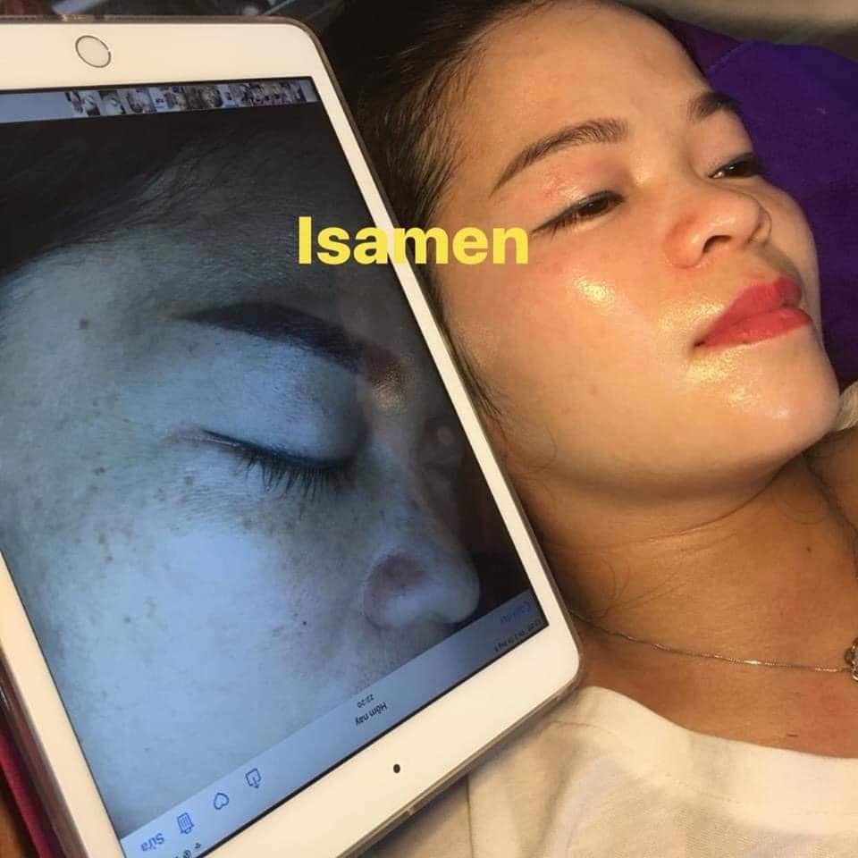 Tinh dầu HA ISAMEN căng bóng da, thu nhỏ lỗ chân lông dành cho da nhạy cảm , mỏng yếu