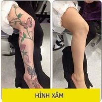 Kem nền che hình xăm / khuyết điểm / sẹo rỗ / mụn