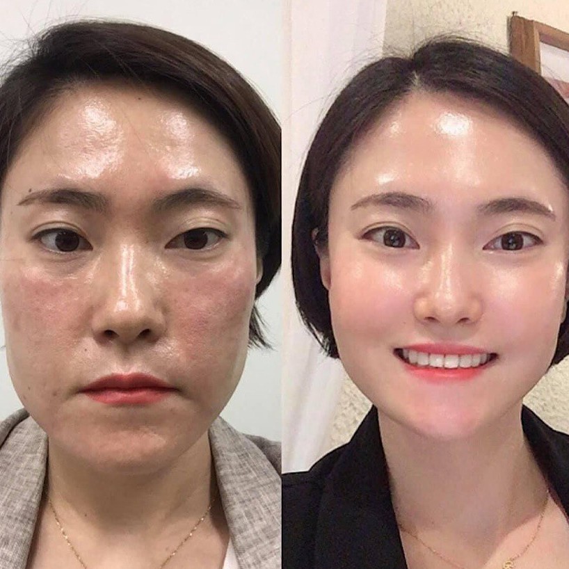 Vỉ Sample Peel da CNP rx Skin Rejuvenating Intensive Peel giúp làm căng bóng da, phục hồi lão hóa, mờ sạm nám.