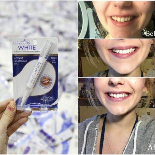 Bút Tẩy Trắng Răng Dazzling White Instant Whitening Pen