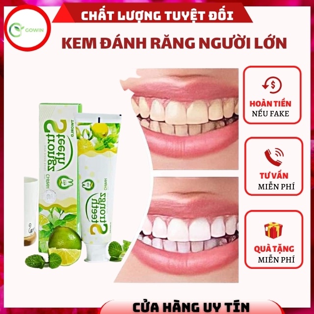[KHÔNG CHỨA ĐỘC HẠI] Kem Đánh Răng Người Lớn Cao Cấp Strongz Teeth Tworld An Toàn Giúp Trắng Răng, Hôi Miệng, Viêm Lợi