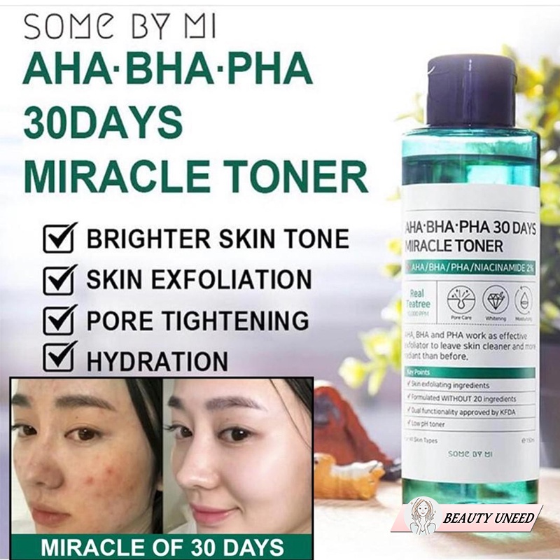 Nước Hoa Hồng Giảm Mụn Some By Mi AHA-BHA-PHA 30 Days Miracle Toner 150ml | BigBuy360 - bigbuy360.vn