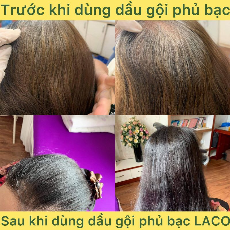 [Siêu ưu đãi] Dầu gội phủ bạc Laco - Lên màu sau 9 phút, không đau xót da đầu, hương thơm thảo dược, an toàn tuyệt đối