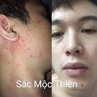 (mua 1 tặng 1 smt cùng loại)Sắc Mộc Thiên 50ML