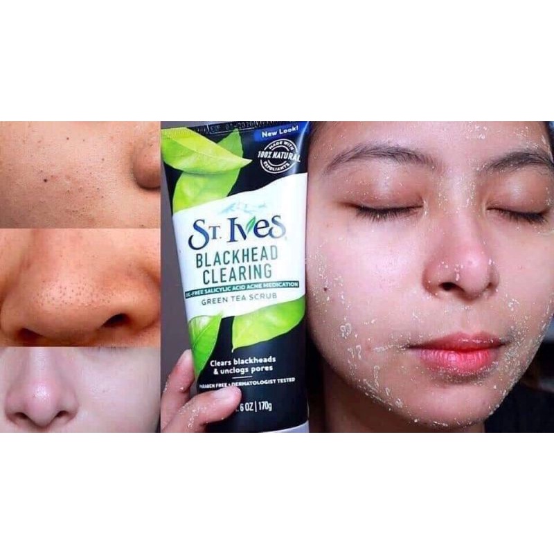 TDC Tẩy tế bào chết ST.IVES BLACKHEAD CLEARING GREEN TEA SCRUB