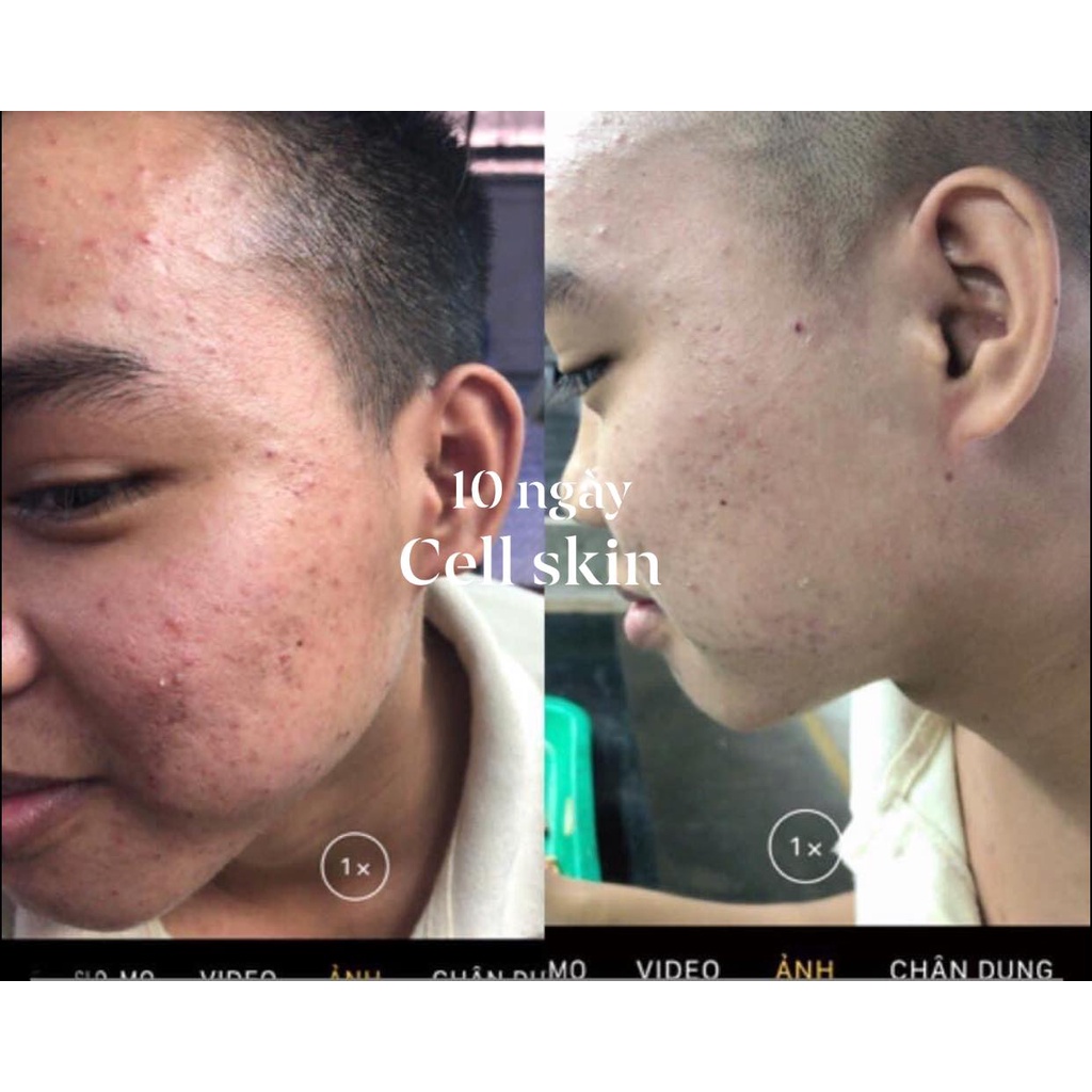 CELLSKIN XANH
