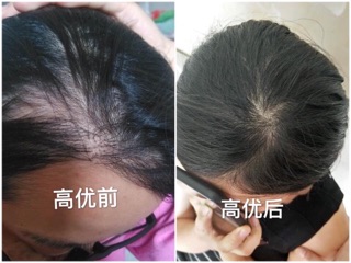 Gội xả Gừng Ginger