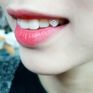 Đá đính răng combo 120k 10 viên