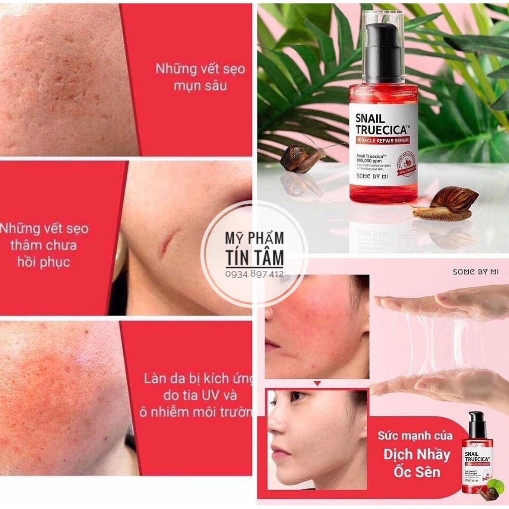 Bộ Kit 4 Món Snail Truecica Some By Mi Miracle Repair Starte - Phục hồi da, cải thiện sẹo lõm