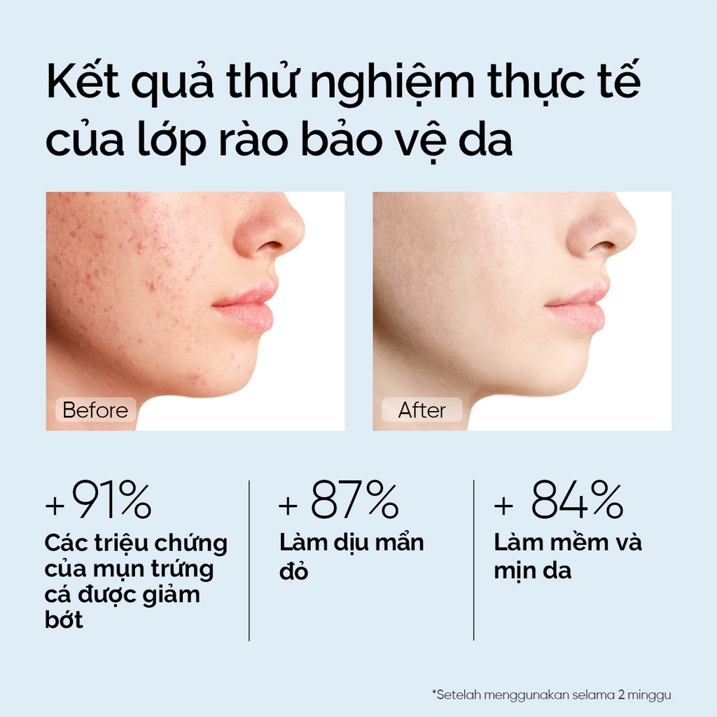 Kem dưỡng ẩm phục hồi 5X Ceramide mini size SKINTIFIC 6g