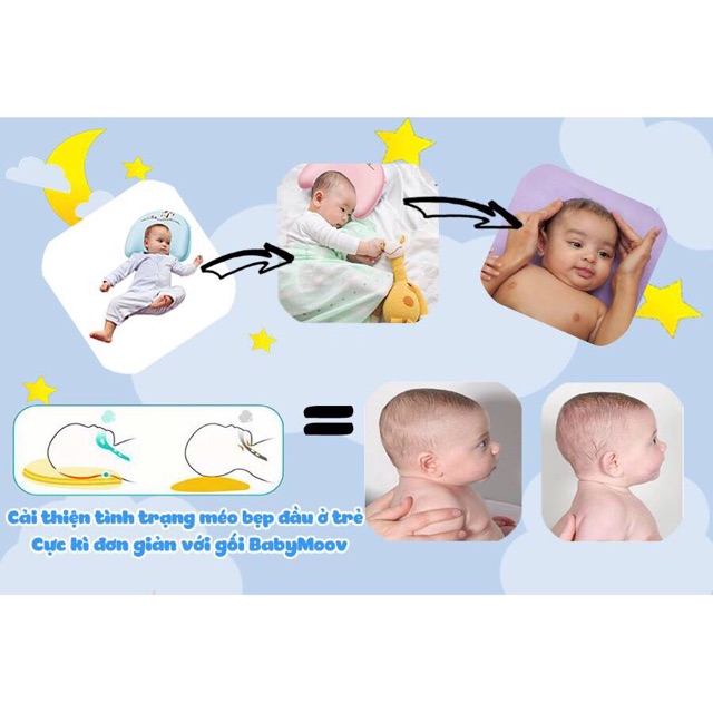 Gối cao su non BabyMoov chống méo, bẹt đầu cho bé phòng ngừa đầu trẻ sơ sinh bị biến dạng hiệu quả