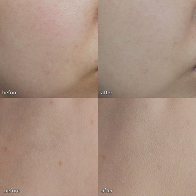 Phấn Nước Hera Black Cushion SPF34/PA++ | BigBuy360 - bigbuy360.vn