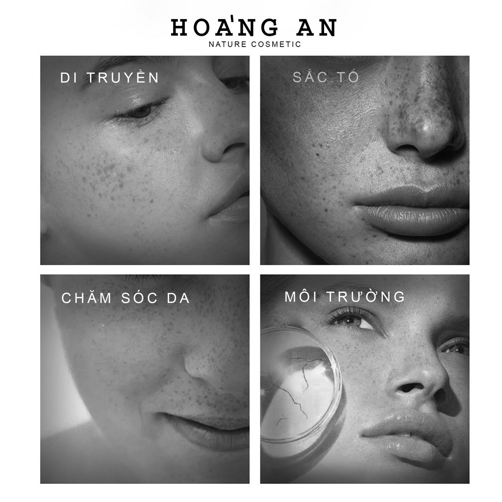 BỘ 5 MÓN NÁM DA CAO CẤP BAIZTON QUẢNG CHÂU CHÍNH HÃNG | BigBuy360 - bigbuy360.vn