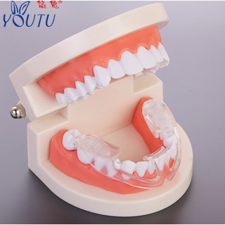 DỤNG CỤ CHO NGƯỜI NGHIẾN RĂNG chăm sóc răng miệng, bảo vệ răng, kỹ thuật của Nhật (Loại bỏ tật nghiến răng khi ngủ )