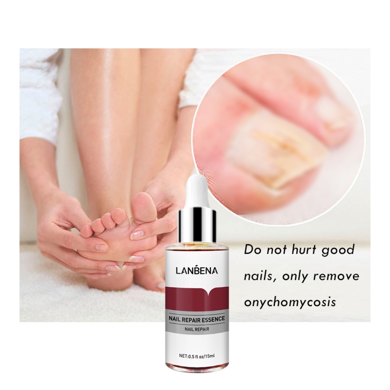 Tinh chất phục hồi móng JULYSTAR chính hãng hỗ trợ giảm nấm móng