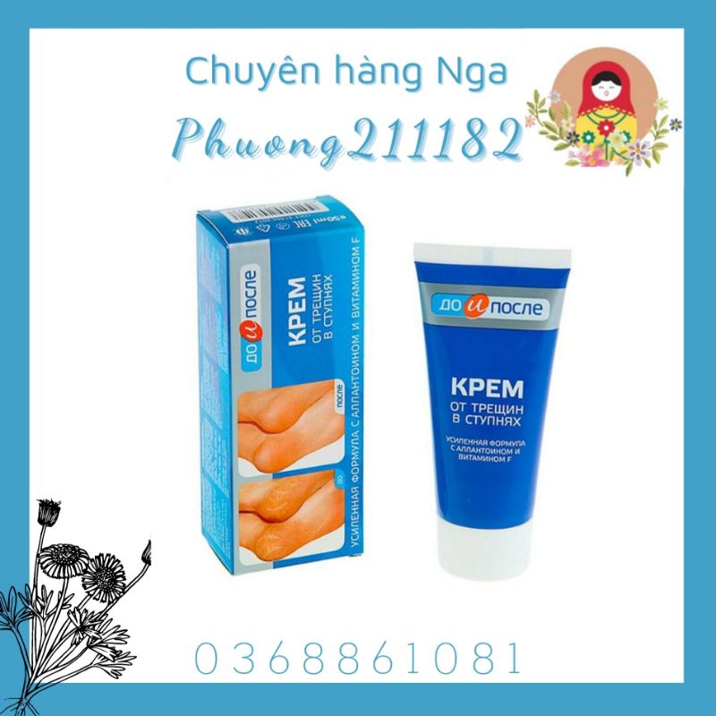 Kem  nứt gót chân nga 50ml