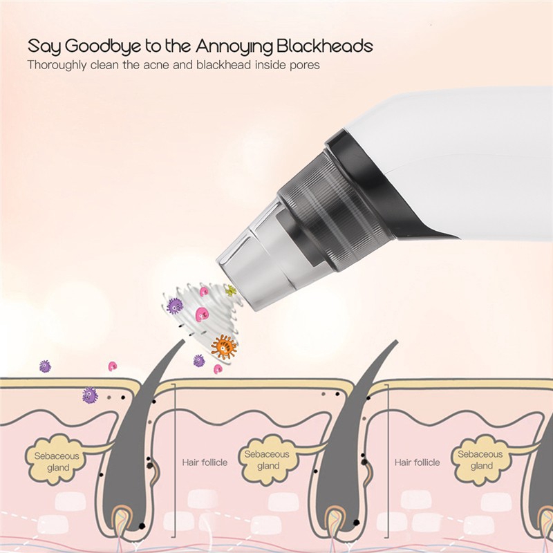 [Mã FMCGMALL - 8% đơn 250K] Máy hút mụn đầu đen CkeyiN thu nhỏ lỗ chân lông | BigBuy360 - bigbuy360.vn