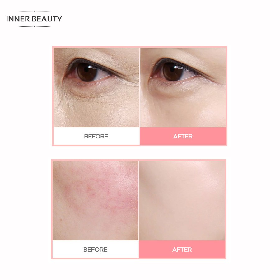 Kem nền dang thỏi ChosungAh TM Super Fit Cover Foundation 2X (Rose Gold Edition) | BigBuy360 - bigbuy360.vn