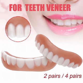 (Hàng Mới Về) Răng Giả Thẩm Mỹ Cho Cả Nam Và Nữ Mã 928