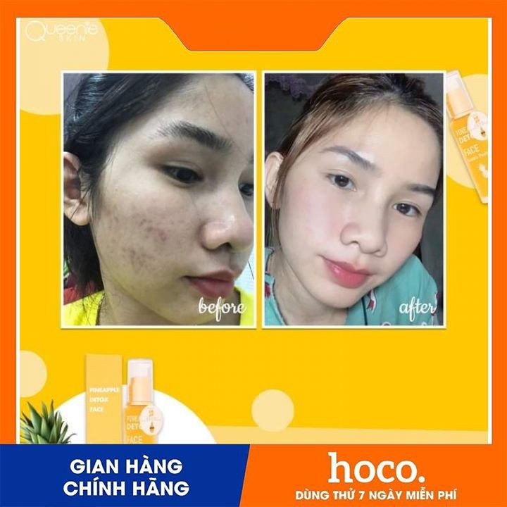 Detox Thảy Độc (Trắng Da ) Queenie Skin | BigBuy360 - bigbuy360.vn