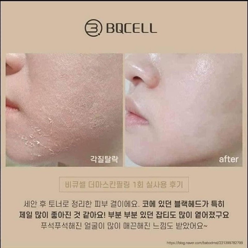 Thay da sinh học Peel Vi Tảo BQCell Derma Skin Peeling Hàn Quốc